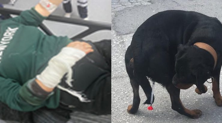Rottweiler cinsi köpeğin saldırısına uğrayan Akkul ölümden döndü